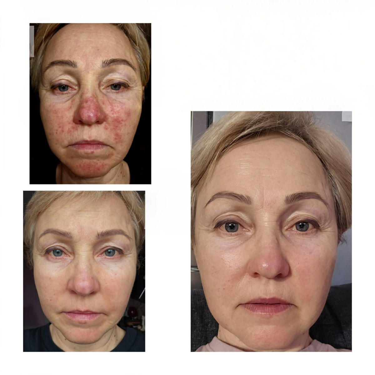 Veido rožinė Mano istorija