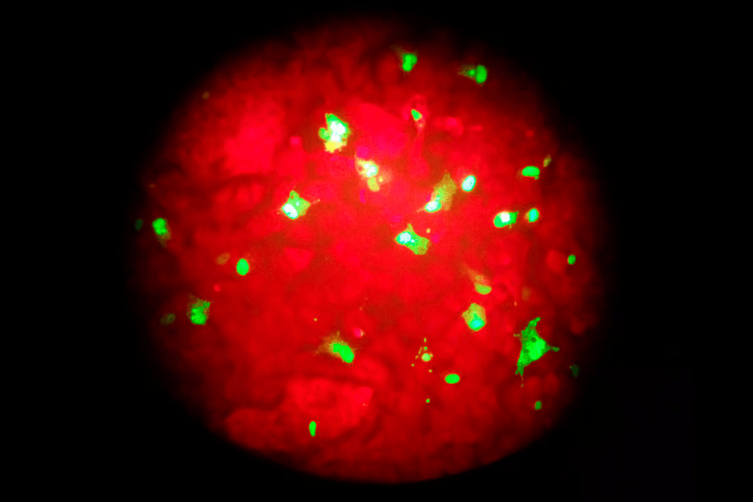 Photo taken through the eyepiece of a microscope, human cells infected with the virus glow green under light from a fluorescence microscope.