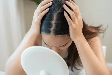 Female pattern bladness, androgenic alopecia. Woman looking at herself in a mirror, holding her head with both hands in a worried pose.