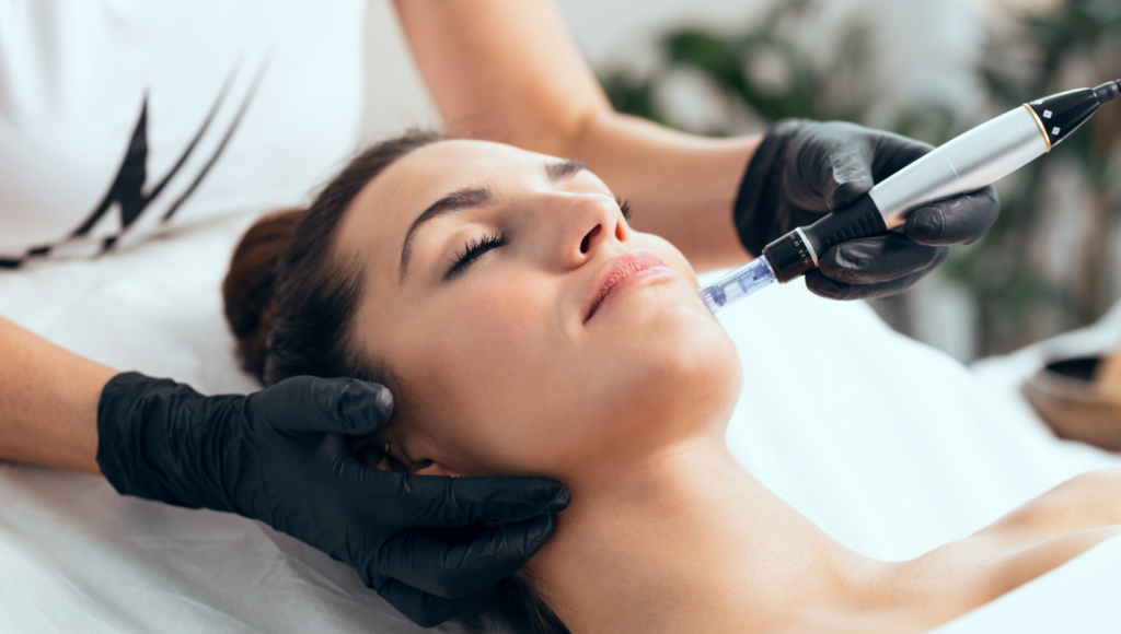 Microneedling-1024x580.png
