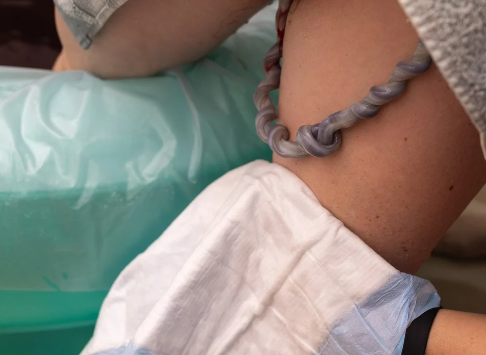 Close-up of a person's arm with a twisted gray bracelet and a white disposable cover or drape.