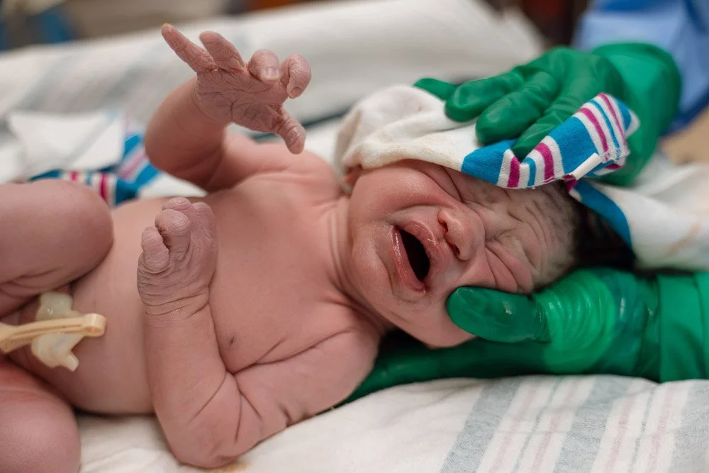 A newborn baby with wrinkled skin crying while being held by a medical professional wearing green gloves, wrapped in a hospital blanket with an IV attached.