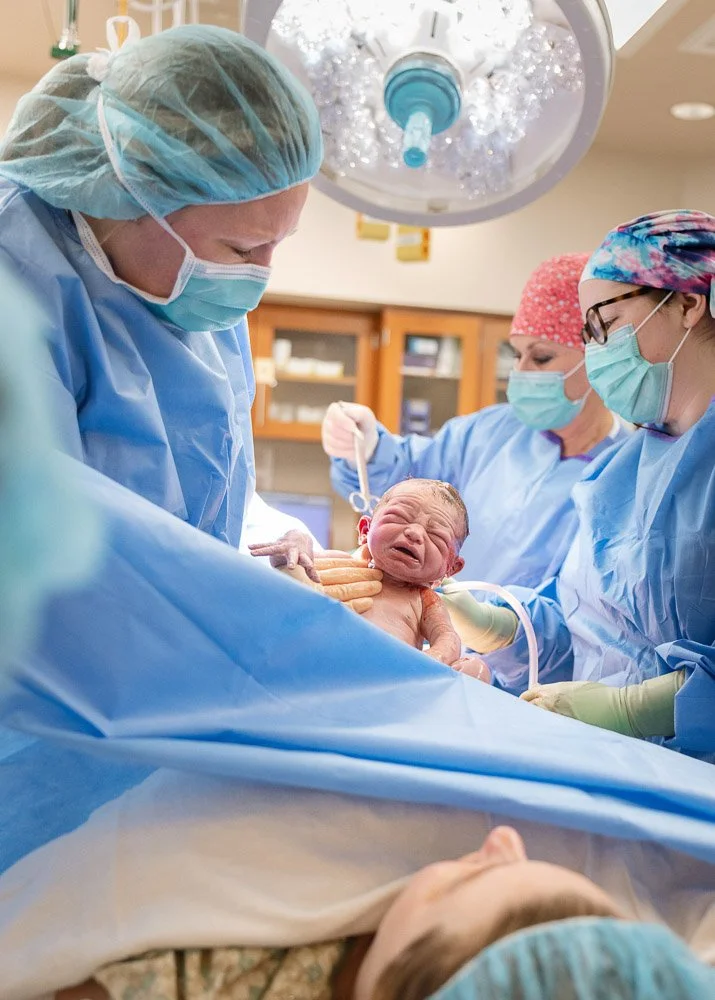 Newborn baby being delivered via cesarean section in an operating room, with medical staff assisting.