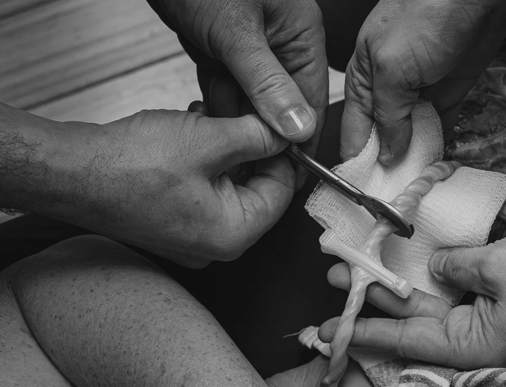 A close-up black and white photo of medical professionals performing an emergency procedure or surgery on a patient’s hand, using surgical tools and gauze.