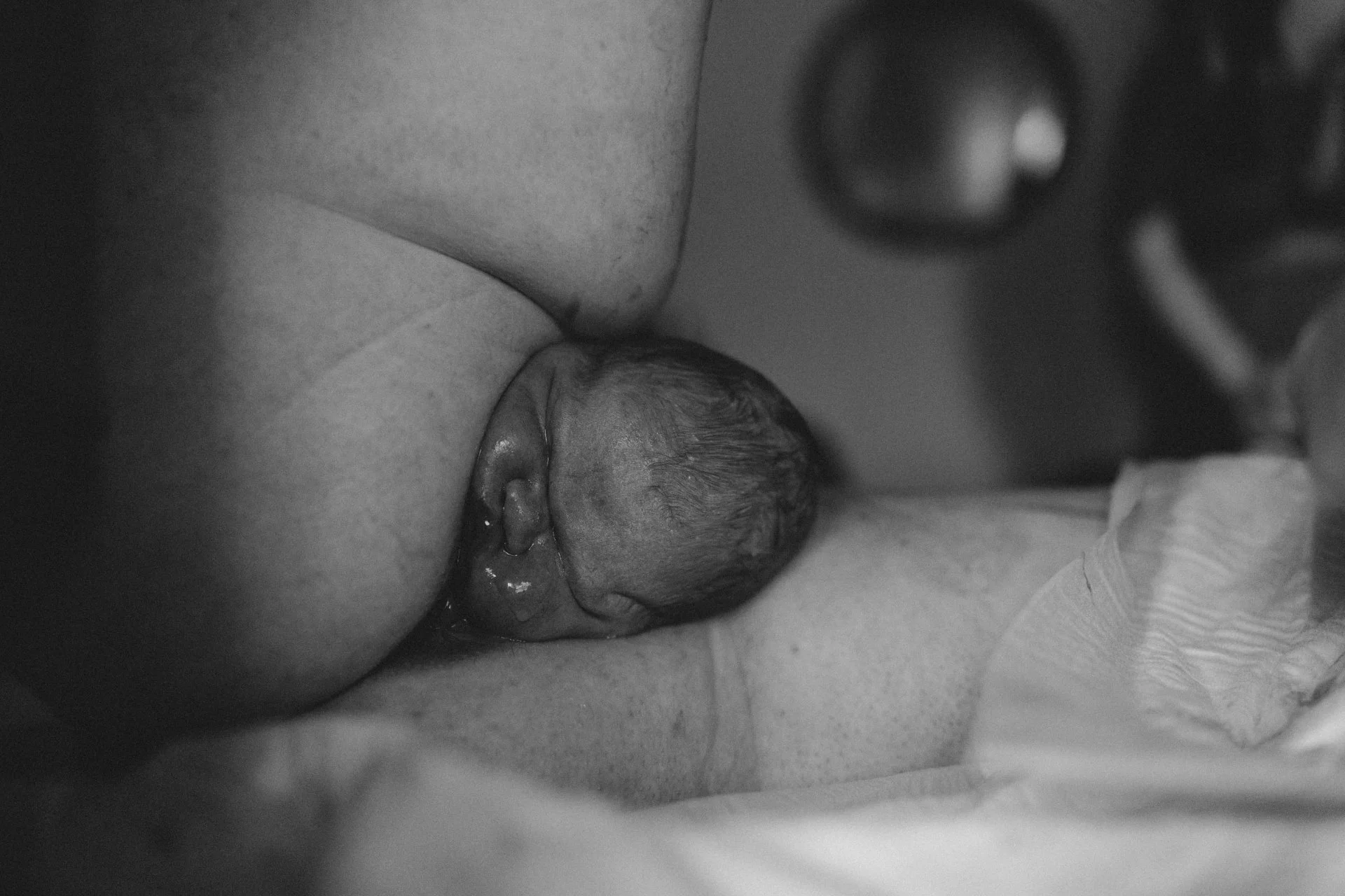 A baby's head crowning from the birth canal  in a black and white photo.