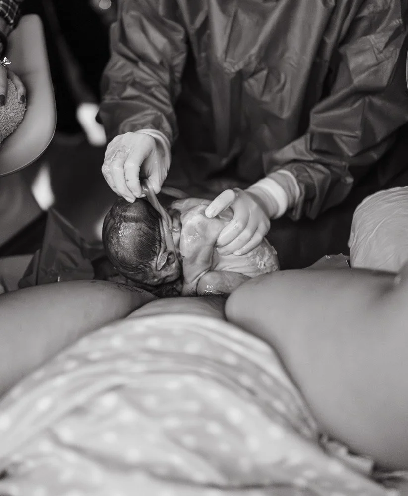 Medical team vaginally delivering a newborn baby during childbirth in a hospital, doctor loosening and removing a nuchal cord 