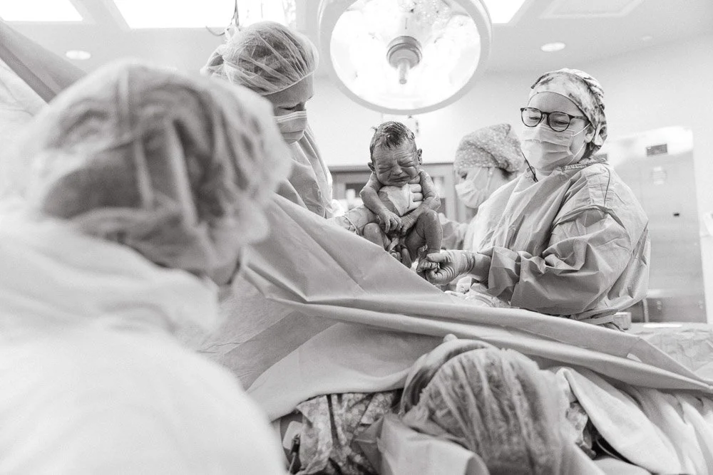 A baby being born via cesarean in a hospital operating room with medical professionals assisting.