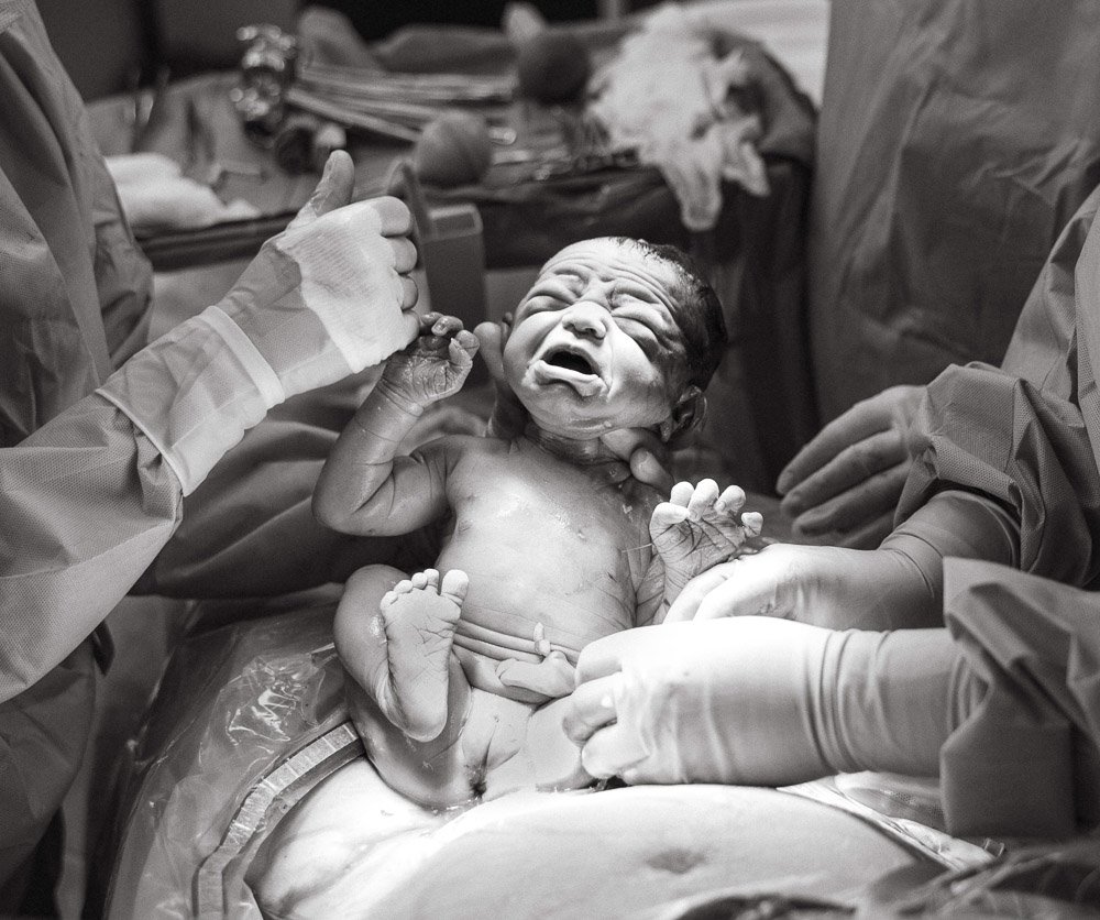 A newborn baby being delivered by medical staff in a hospital delivery room, with the baby crying.