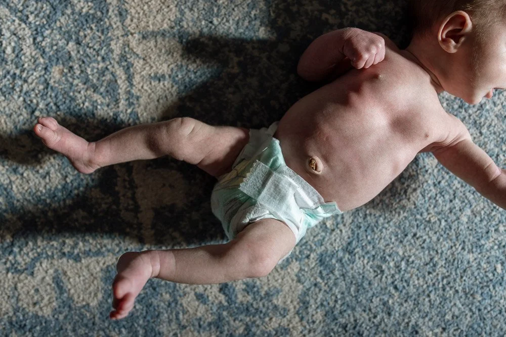 A baby lying on a textured carpet, wearing only a diaper.