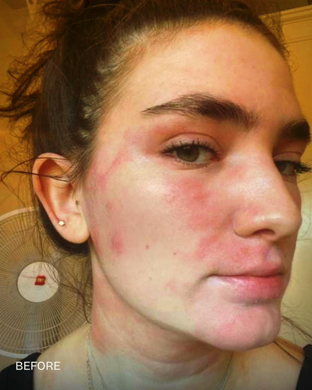 Eleanor-Mayne-before-pic-FIT-testing-clinic.png