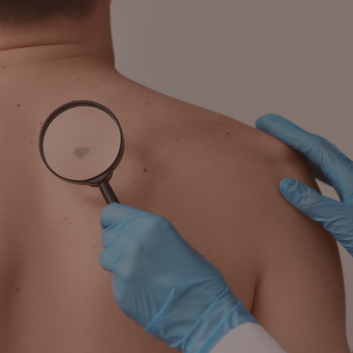 Skin Check