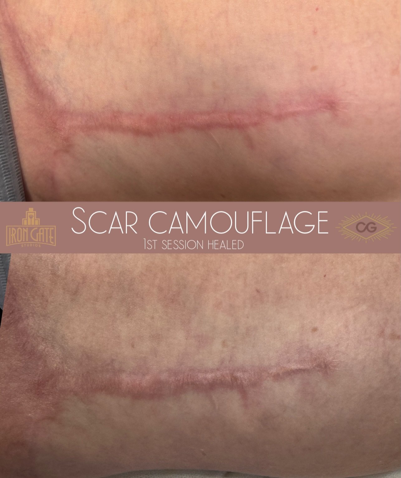 Work in progress - and healed from our first session. 
I&rsquo;ve got February and March availability and would love to do more of this. 
Check out my booking link
❤️&zwj;🔥 https://catgreenpmu.as.me/