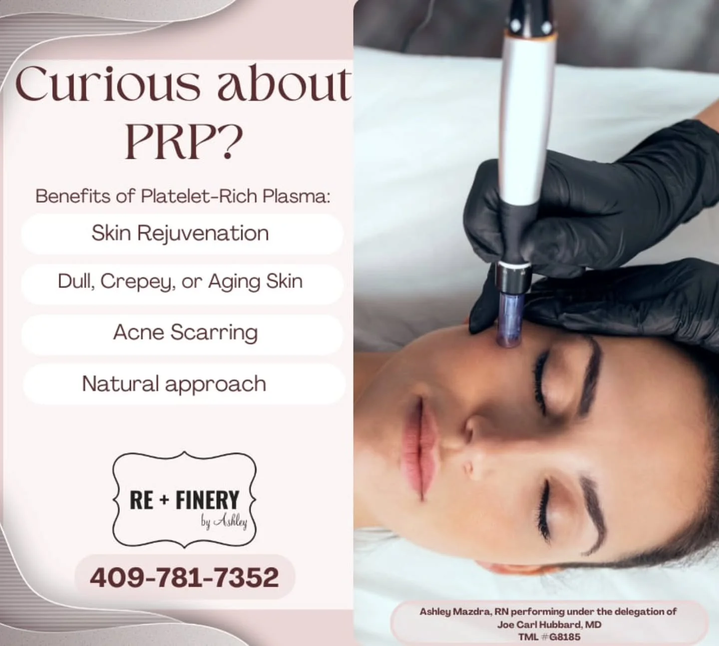 Special Delivery today!!!

🖤💉🖤 PRP Supplies 🖤💉🖤

Text or DM to get Scheduled

All services are performed by a licensed provider under the Delegation of Dr. Joe Hubbard TML #G8185. This post is for informational purposes only and is not intended