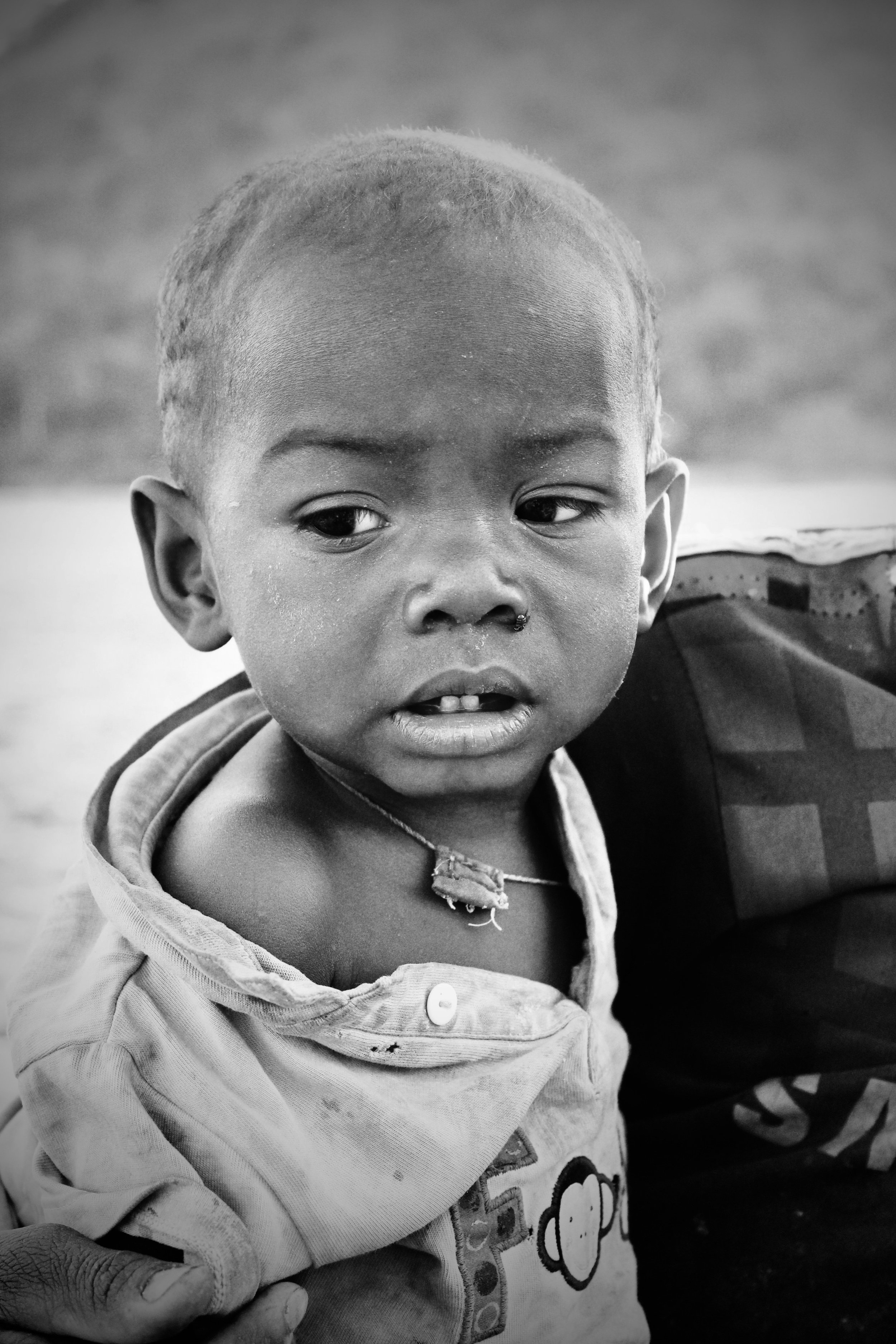 Black and white photo of a young Malagasy child with short hair, a nose piercing, and a torn shirt, looking slightly to the side.