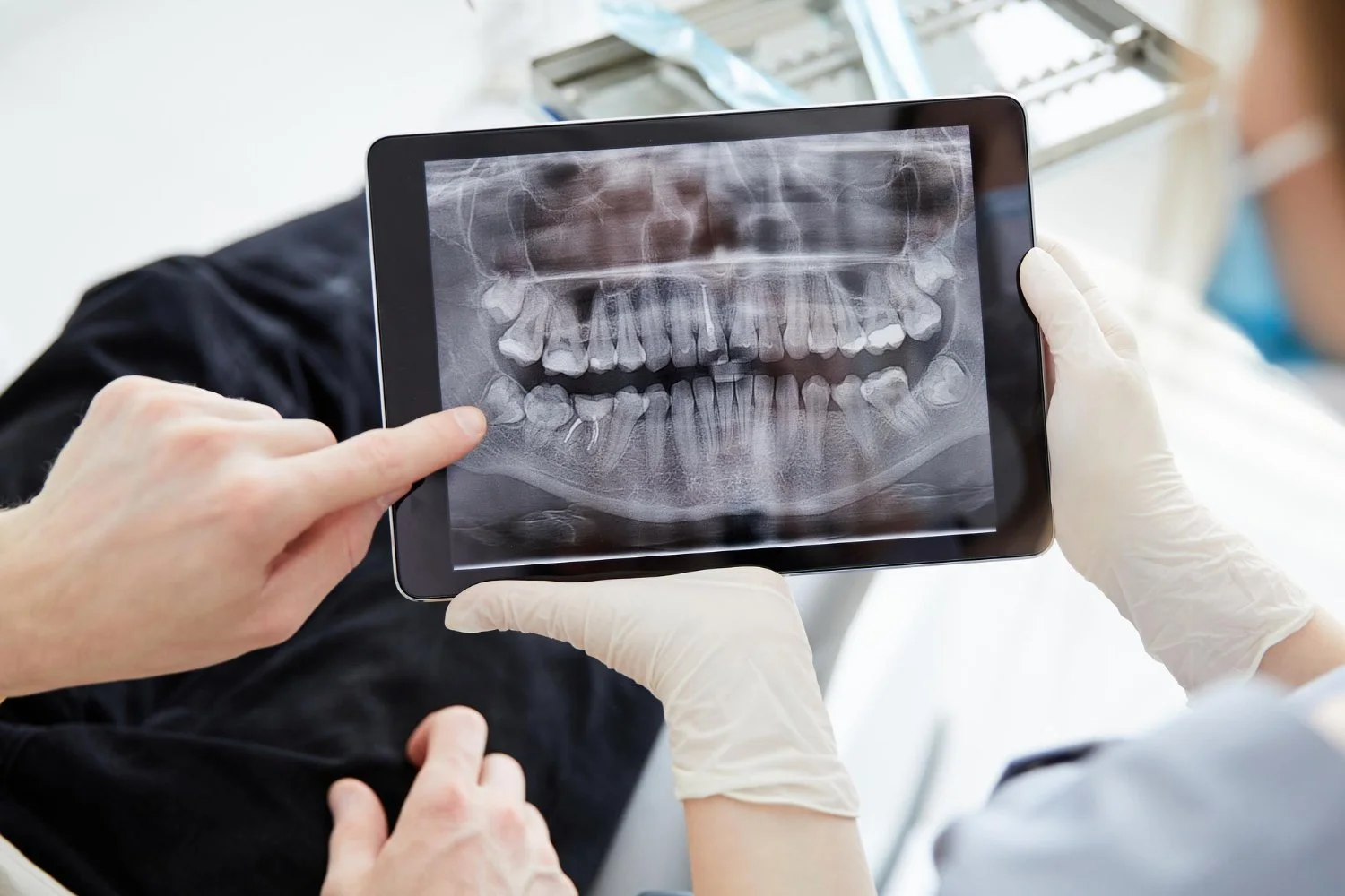 Doctor holding a tablet showing a dental X-ray of a patient’s teeth, with other healthcare professionals nearby.