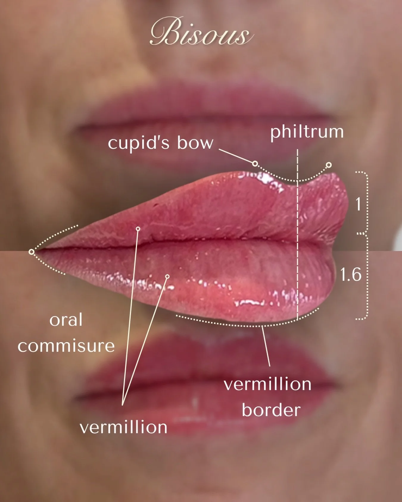 Lip treatments at Bisous are not about volume, they&rsquo;re about balance.

Understanding lip anatomy is what allows results to look refined, not overdone. From the cupid&rsquo;s bow to the vermillion border, every detail plays a role in overall har