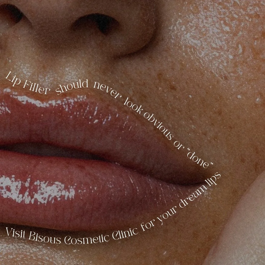 Lip filler should feel like you, only softer, more balanced, and more hydrated.

At Bisous, we take a measured approach to lip enhancement: preserving your natural shape, refining proportion, and building results that feel subtle by design.

Refreshe