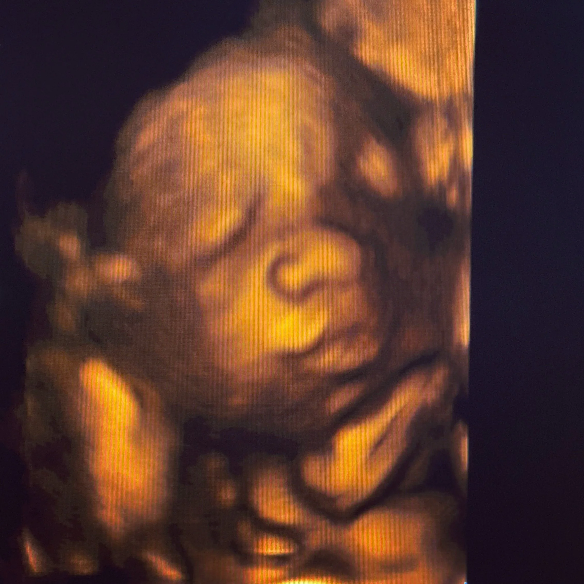 Private 3D/4D Ultrasound Experience
