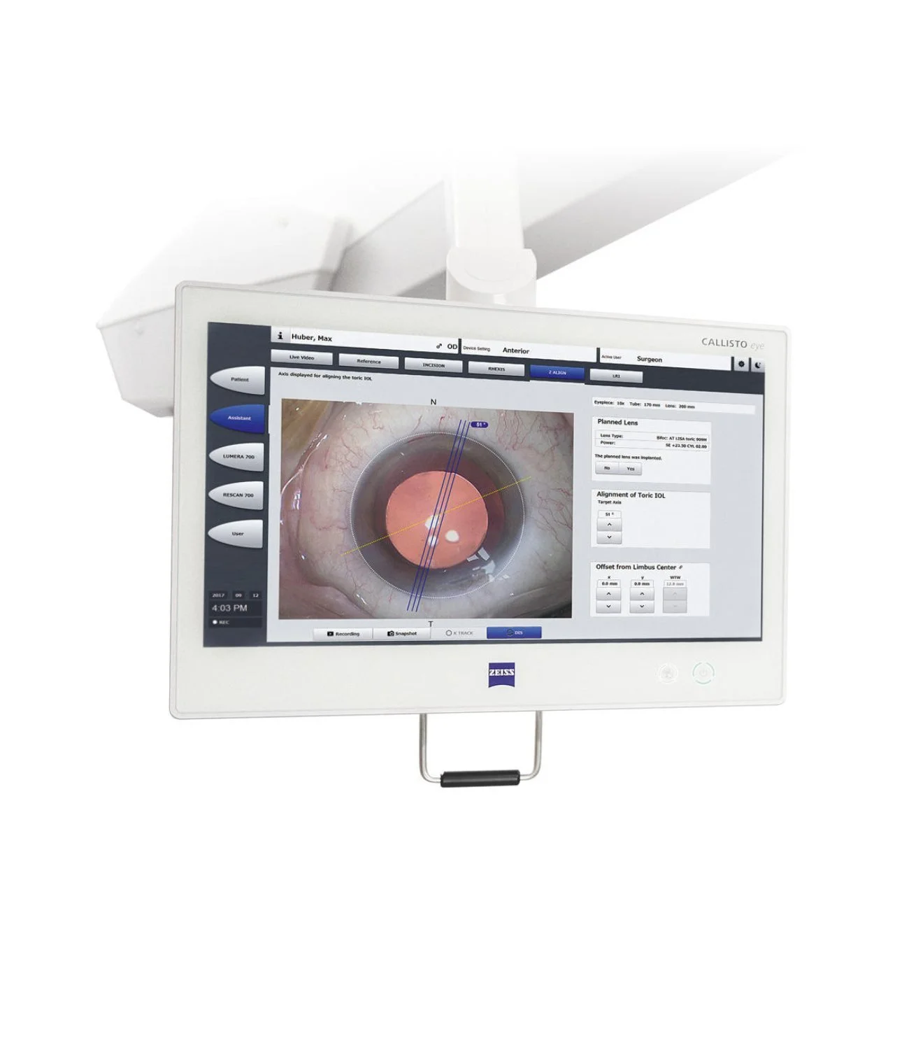 Callisto Eye ψηφιακή καθοδήγηση για ακριβή ευθυγράμμιση τορικών και premium ενδοφακών