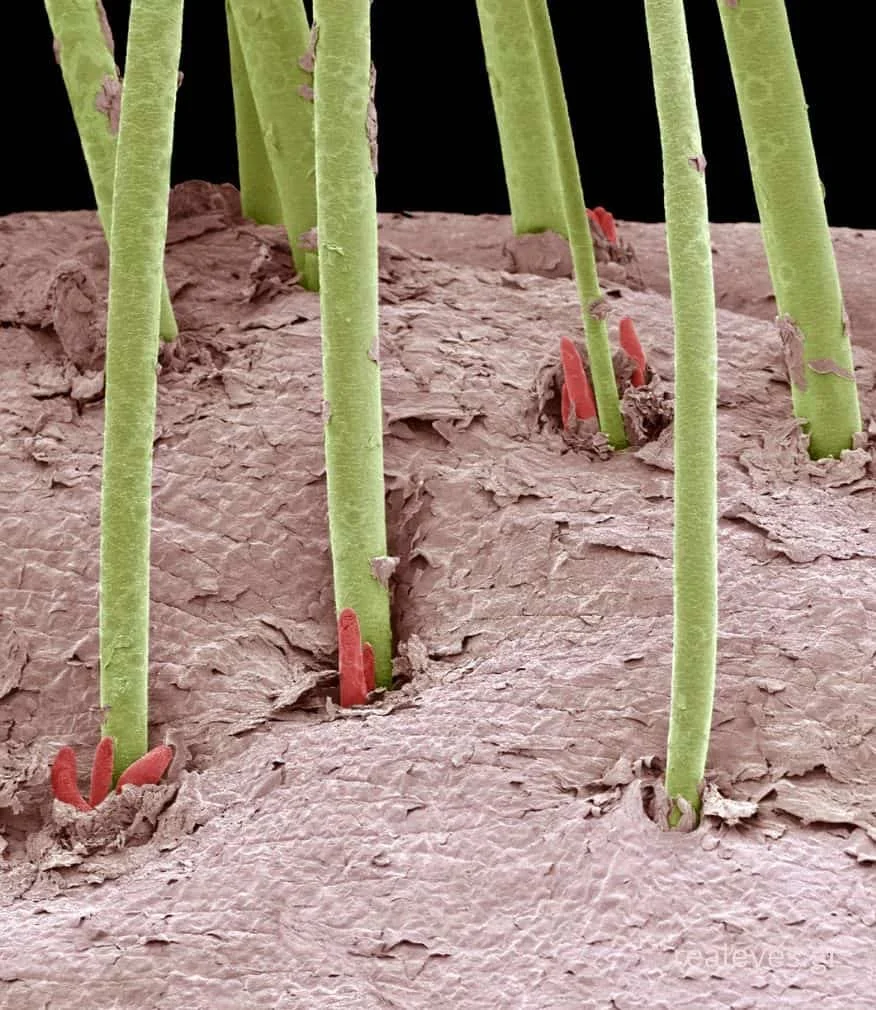 Demodex και βλεφαρίτιδα: αιτία ξηροφθαλμίας και δυσλειτουργίας μειβομιανών αδένων