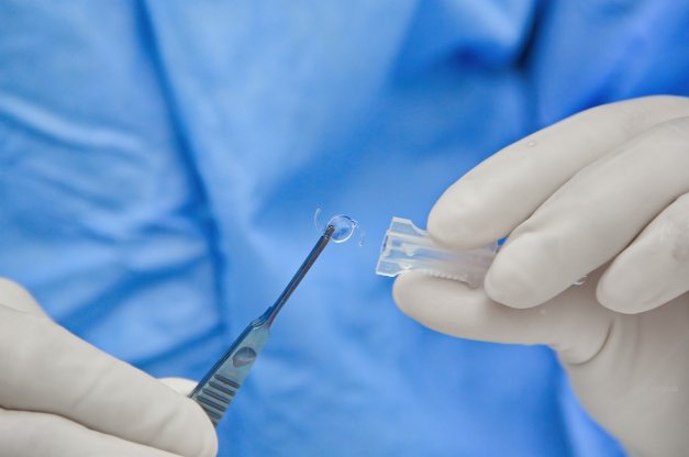 Τοποθέτηση πολυεστιακού ενδοφακού κατά την επέμβαση καταρράκτη