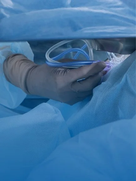 Close-up of a person wearing medical gloves handling a clear plastic medical device while surrounded by blue surgical drapes.