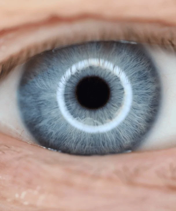 PresbyLASIK laser πρεσβυωπίας Αθήνα – καθαρή όραση κοντά και μακριά χωρίς γυαλιά | RealEyes | δρ. Γκόγκος Μανώλης