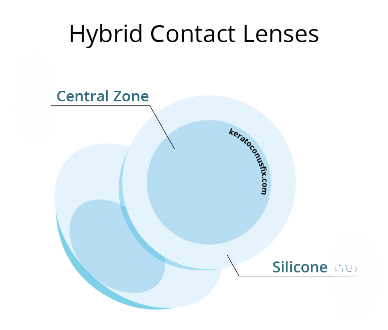 Υβριδικοί φακοί επαφής για κερατόκωνο