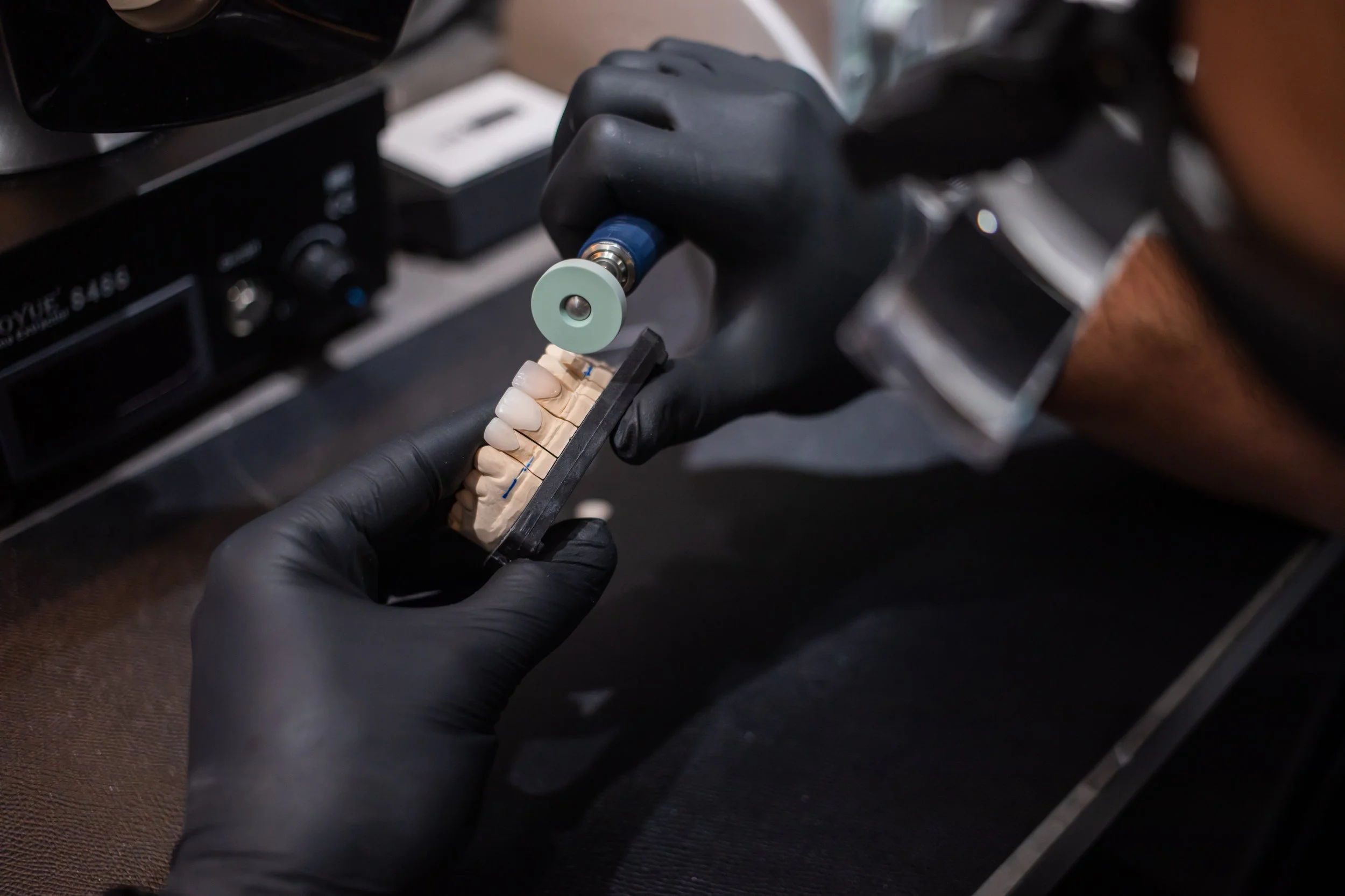 Anterior Zirconia Multi-layer