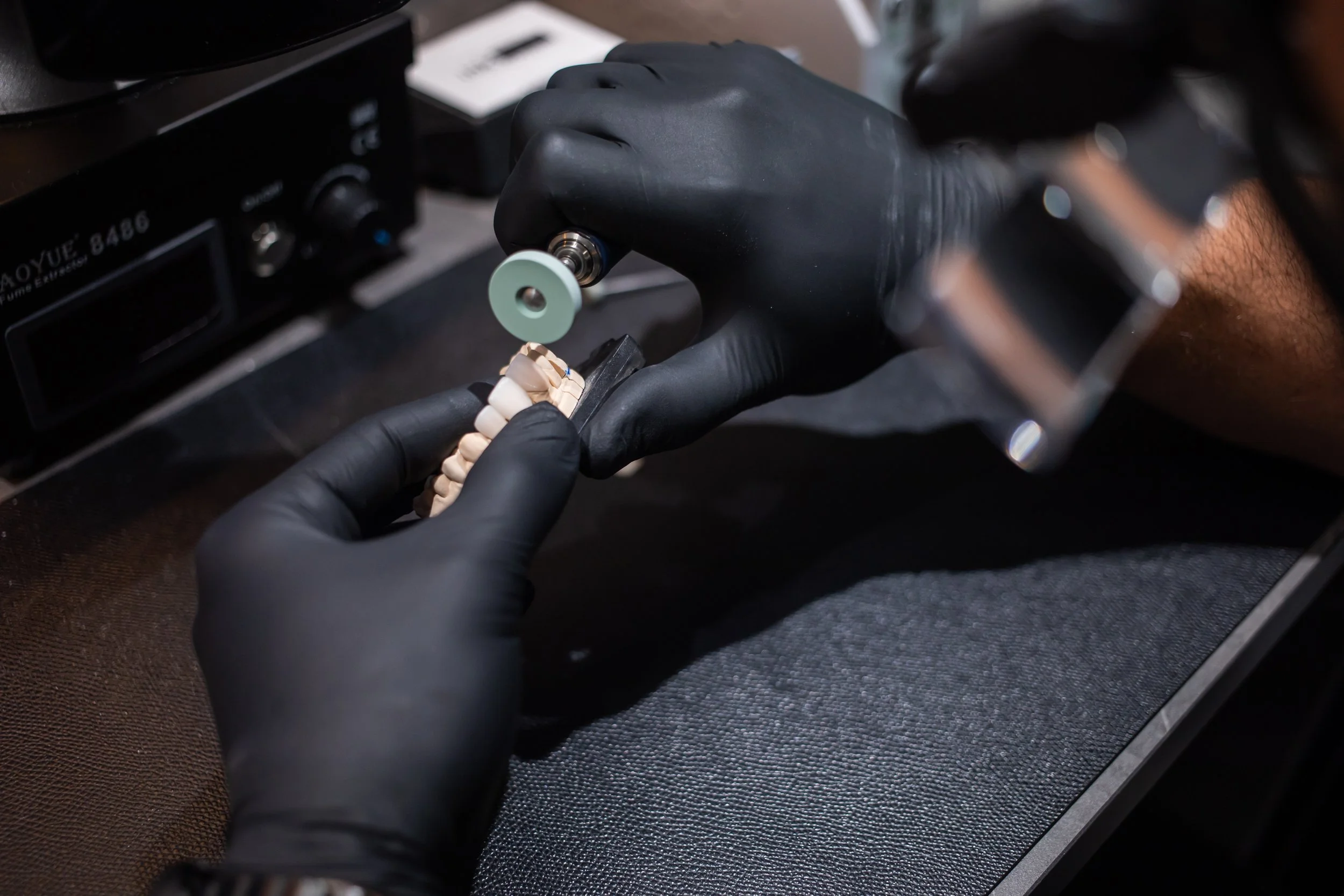 Crown and Veneers (Stain and Glaze)