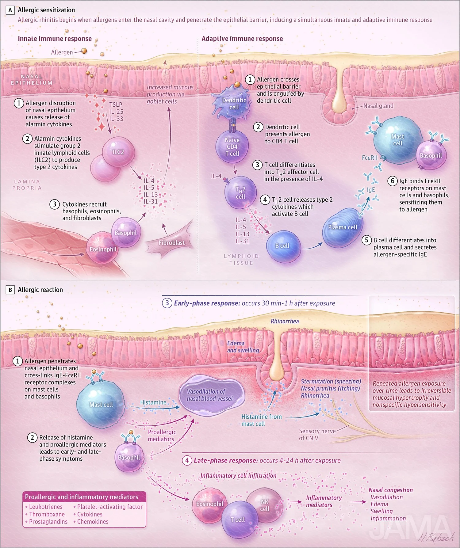 Pathophysiology of allergic rhinitis