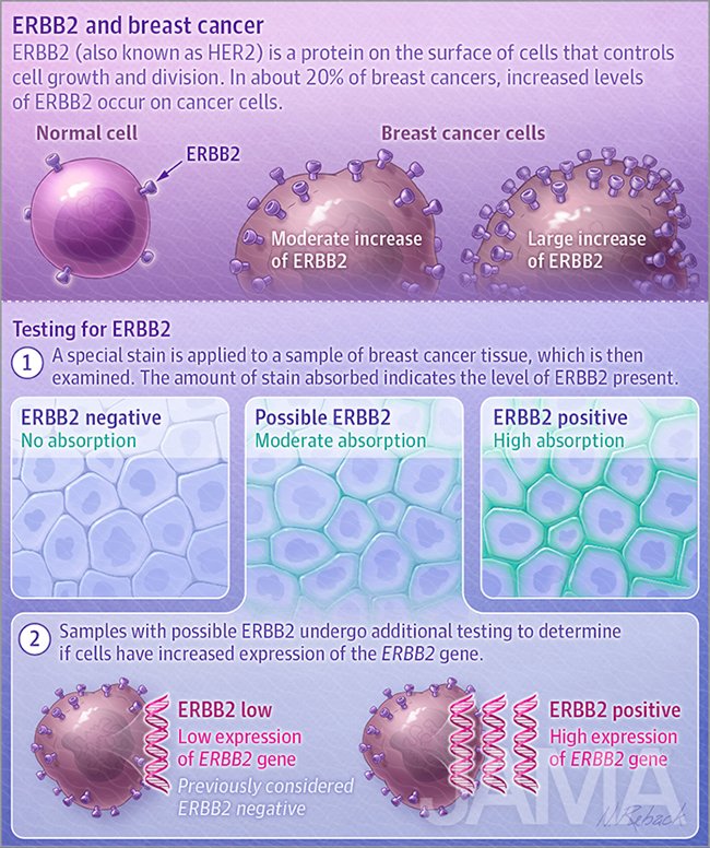 ERBB2 and breast cancer