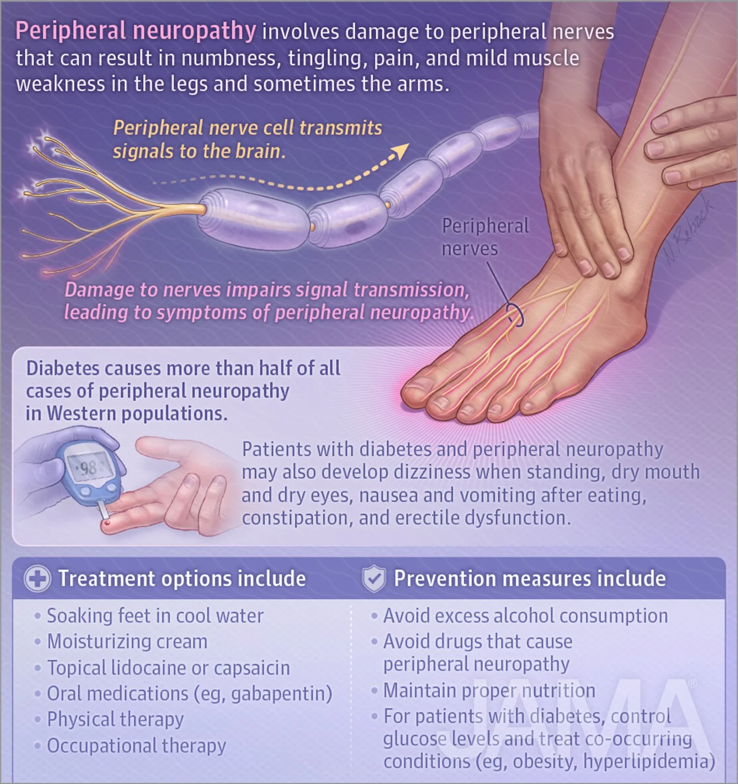 Peripheral neuropathy