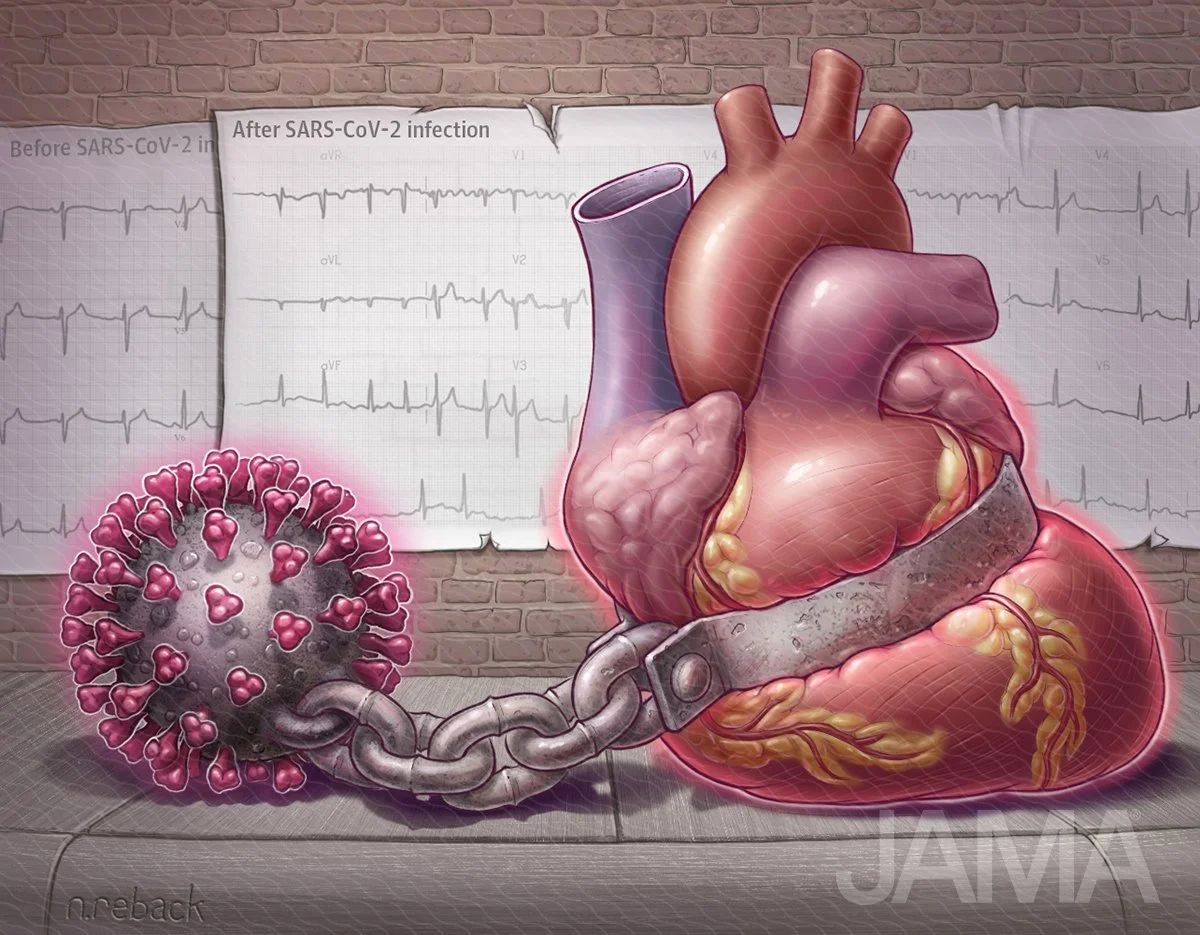 The COVID Heart: one year after SARS-CoV-2 infection