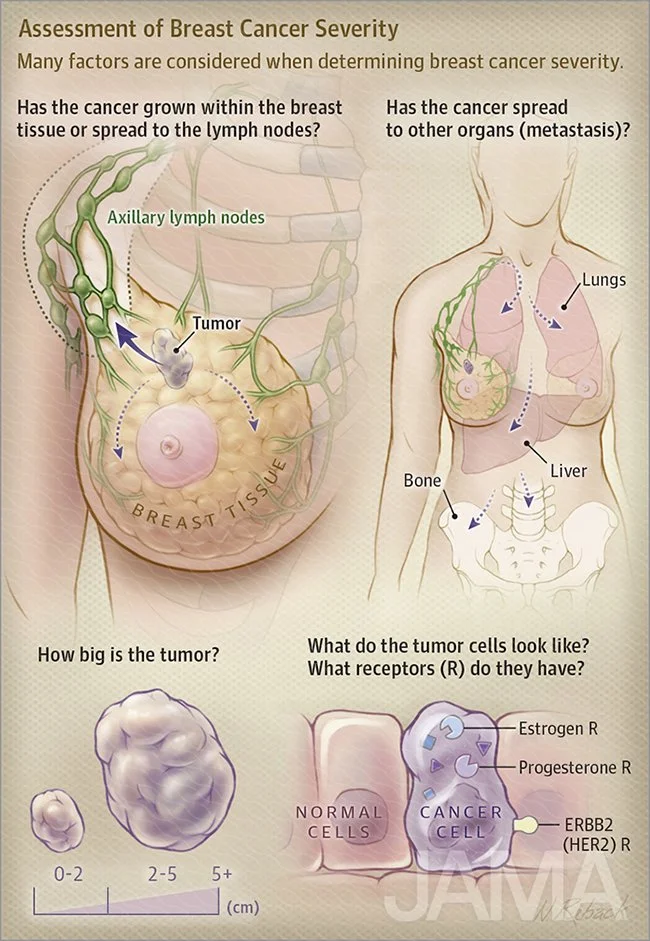 Assessment of breast cancer