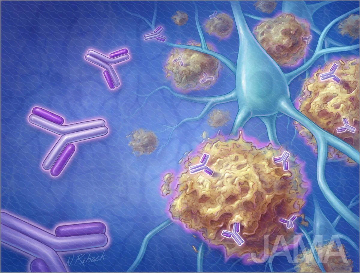 Recently approved Alzheimer drug raises questions