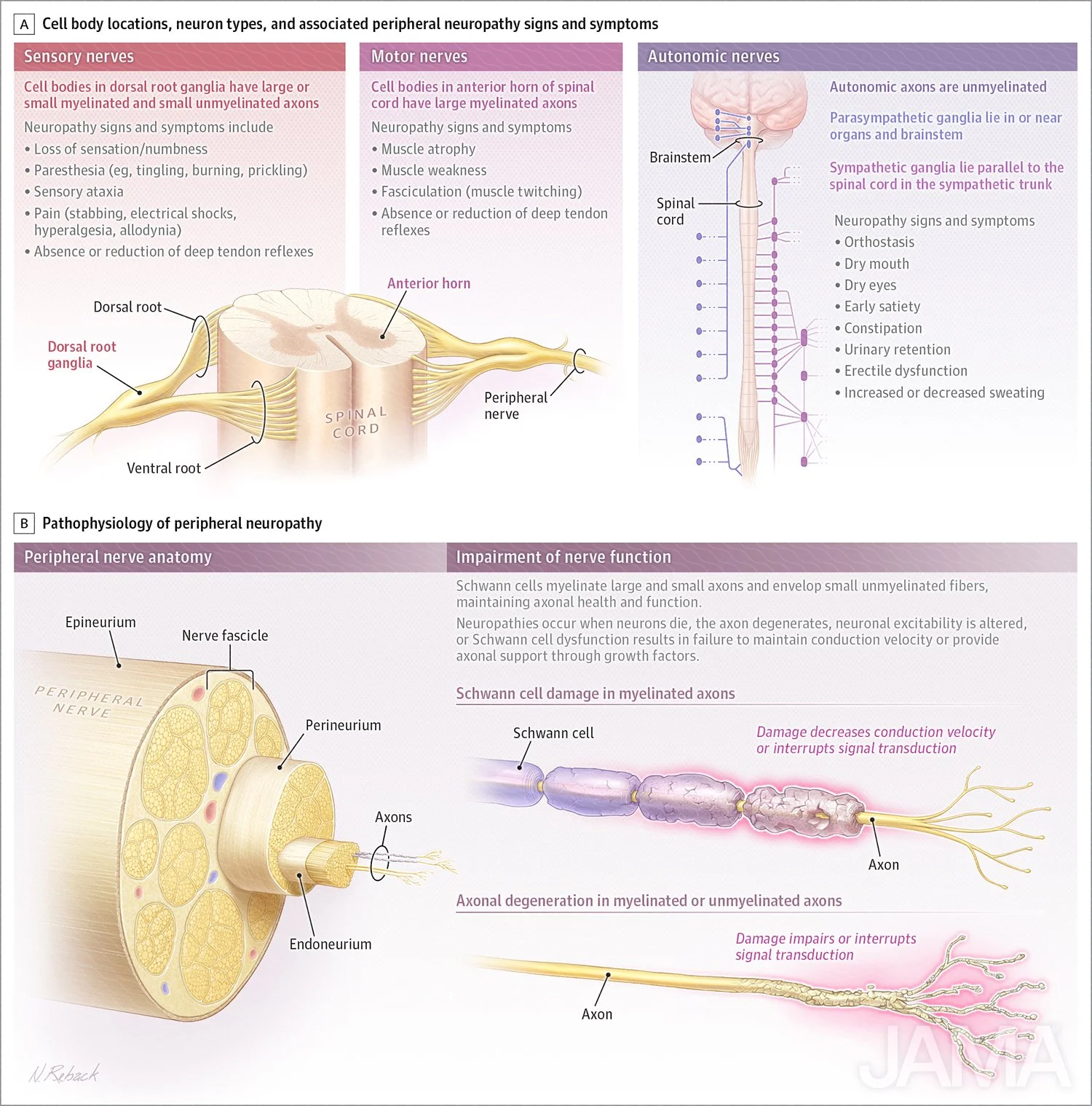 Peripheral neuropathy