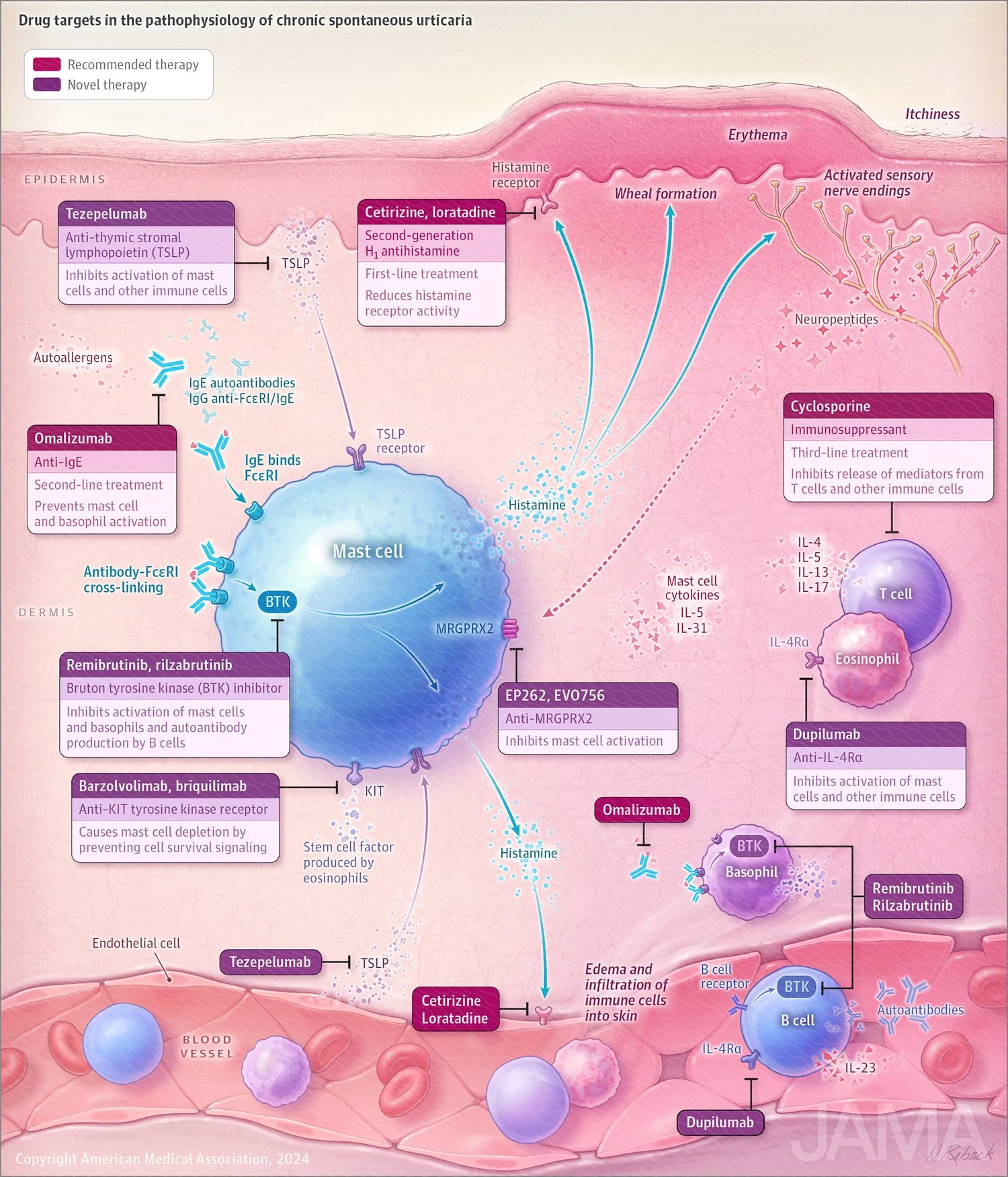 Drug targets in chronic spontaneous urticaria