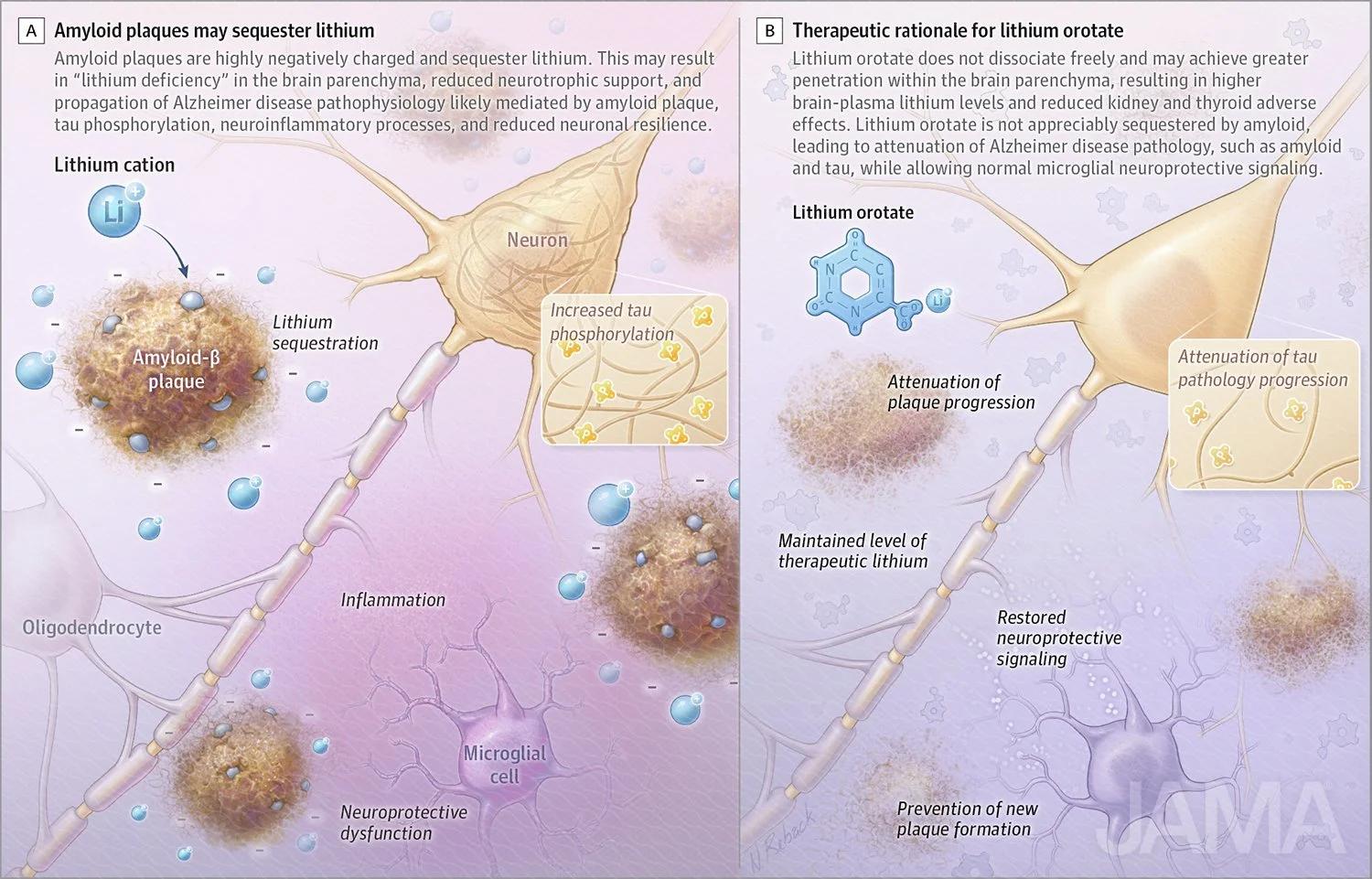 Lithium orotate therapy for dementia