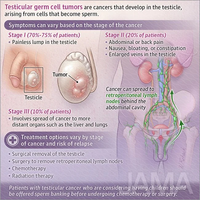 Testicular germ cell tumors