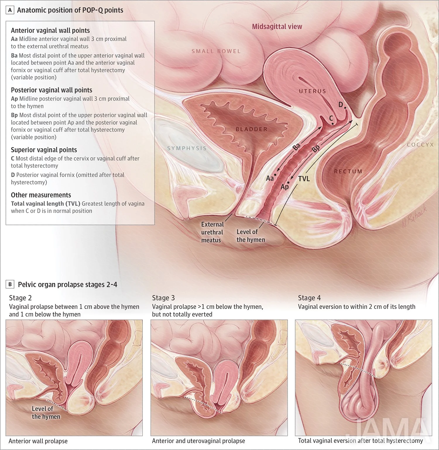 Anatomy of POP-Q points