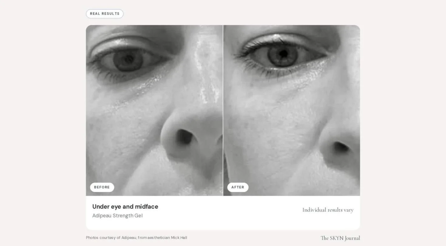 adipeau_before_after_05.jpg
