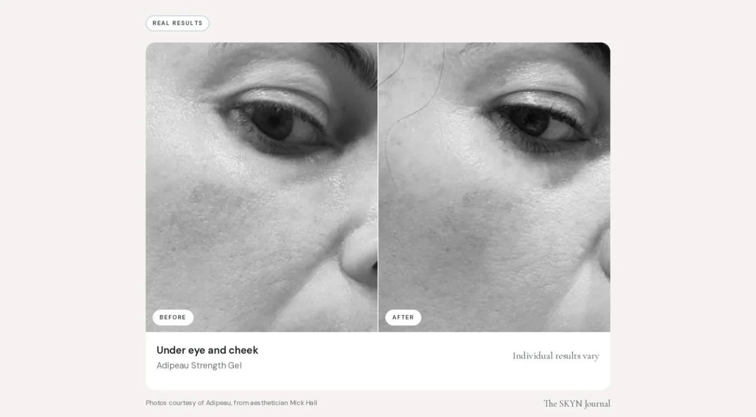 adipeau_before_after_06.jpg