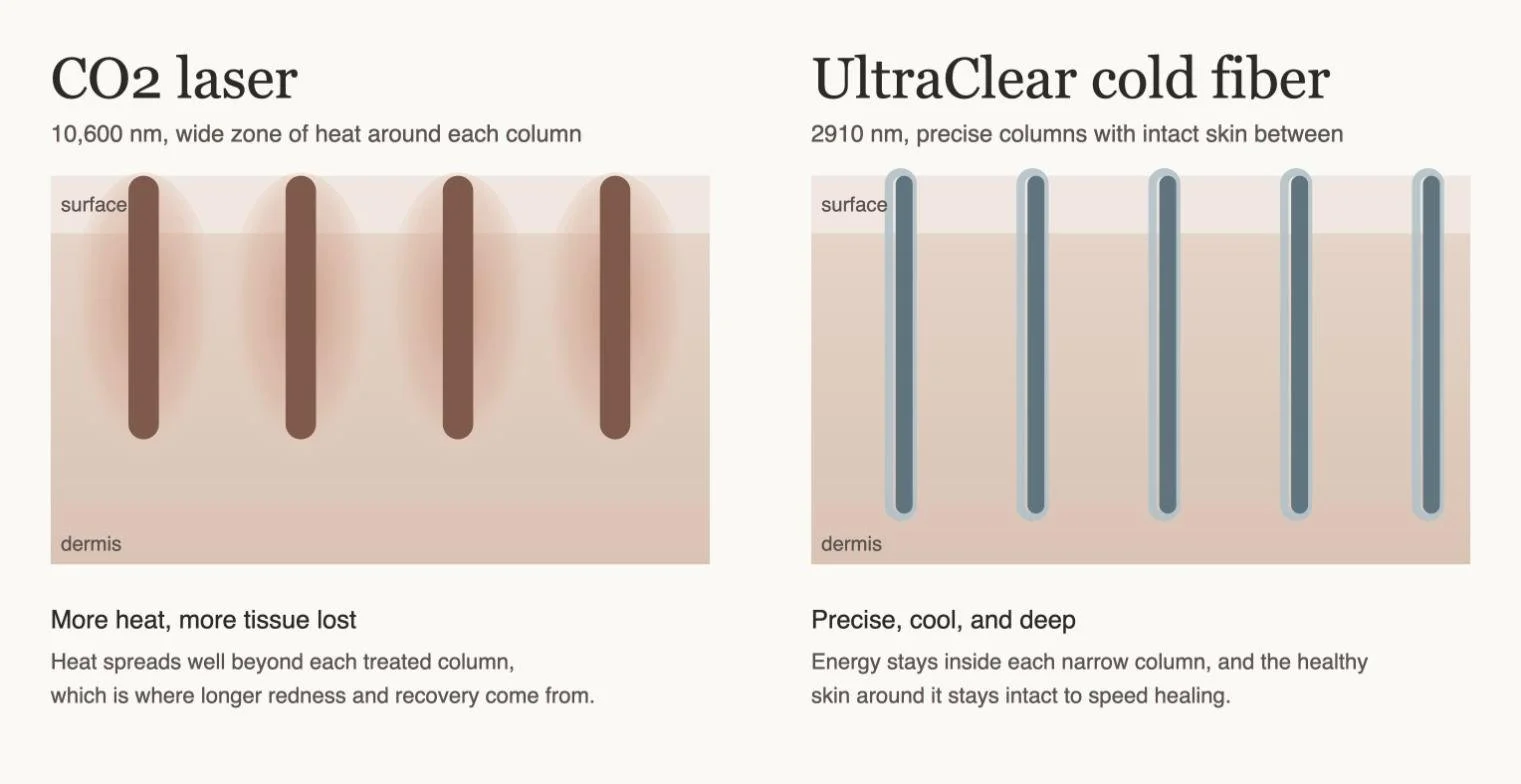 Comparison of CO2 laser heat spread versus UltraClear 2910 nm cold fiber laser precision