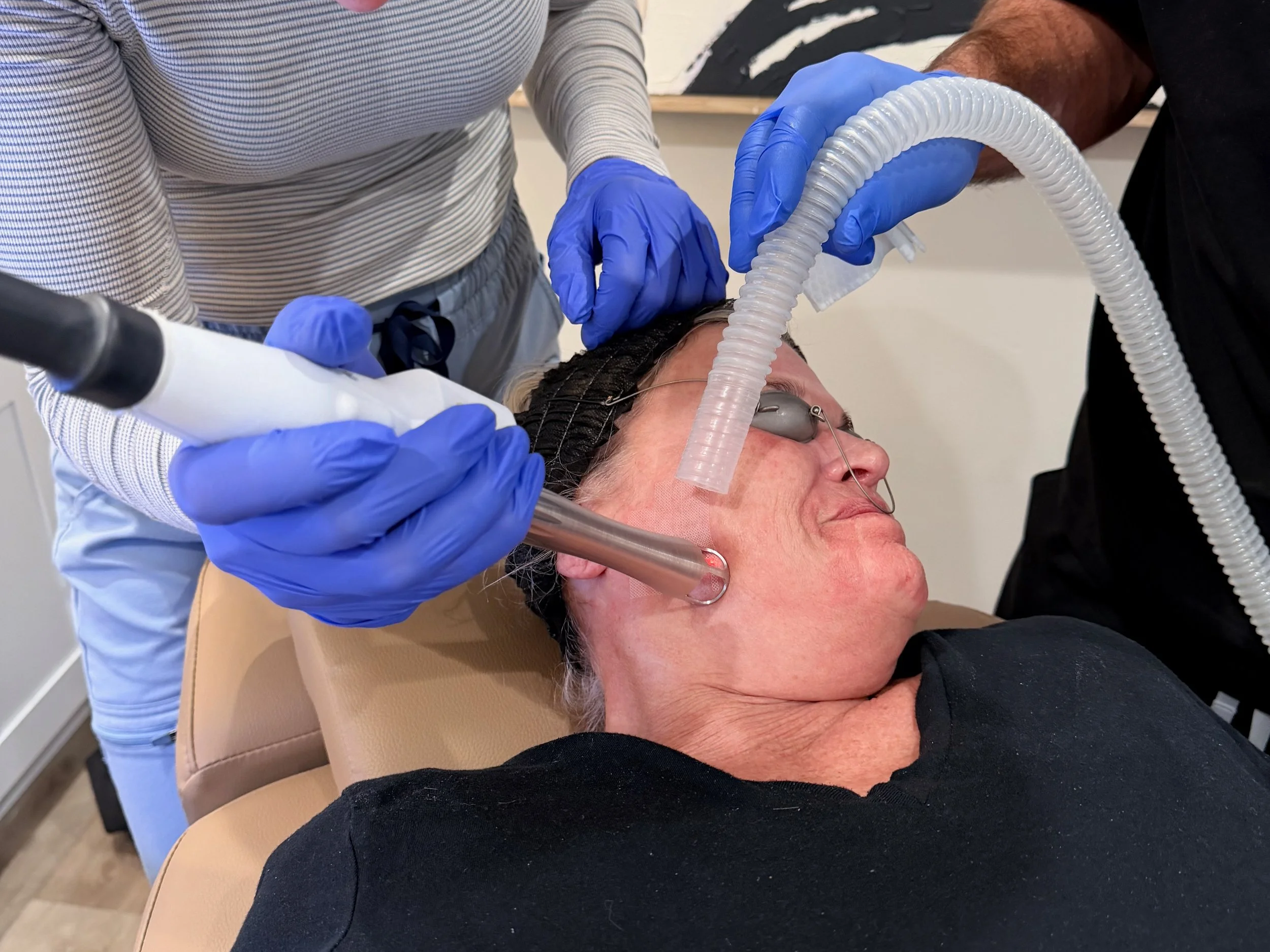 SKYN practitioners performing an UltraClear Laser Coring treatment in Star, Idaho