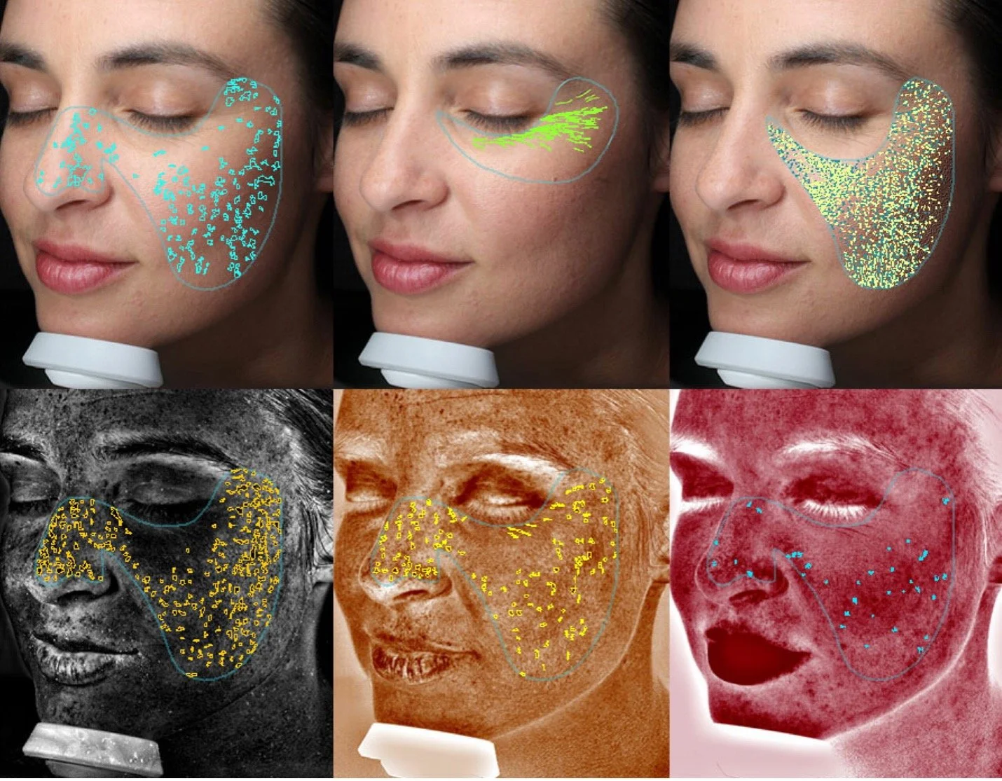 VISIA Skin Analysis
