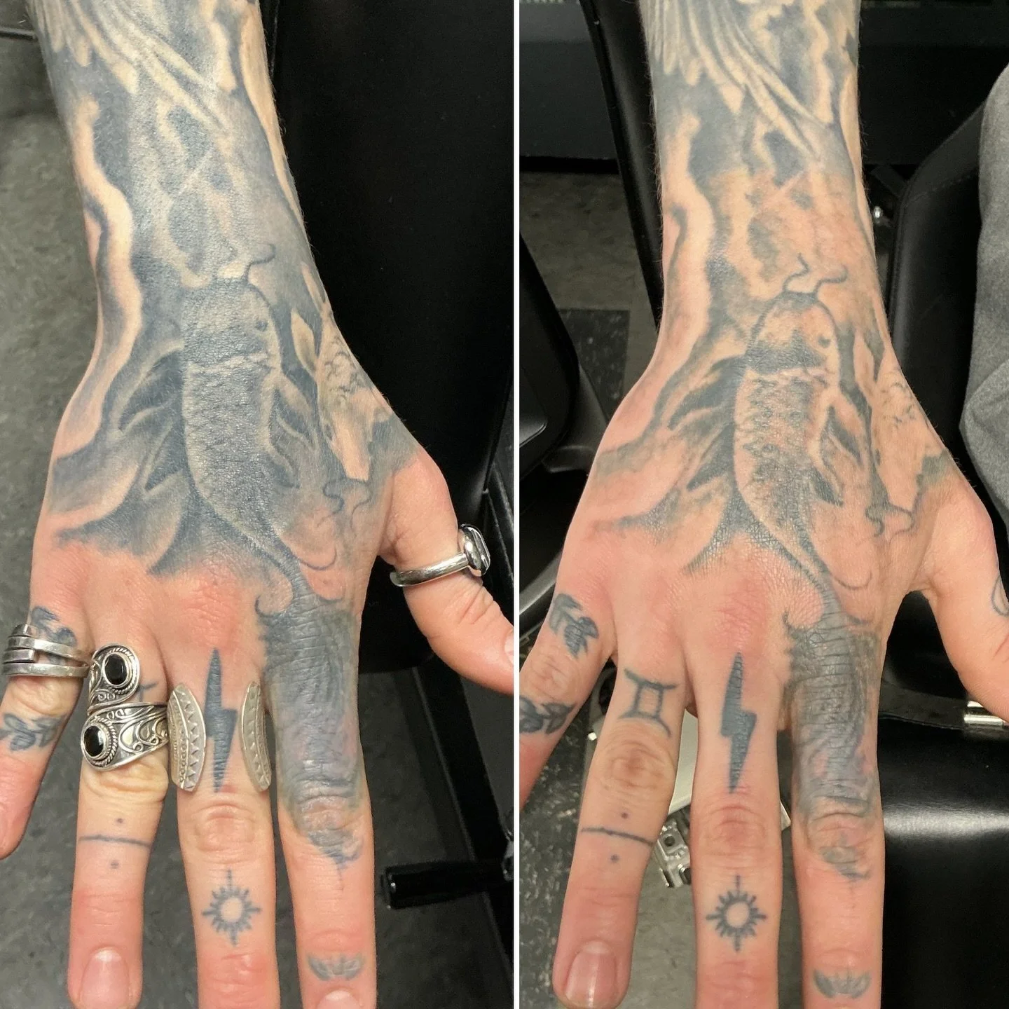 One treatment down on this wonderful client&rsquo;s koi fish for cover-up!

#lasertattooremoval #tattoo #lasertattooremovalspecialist #hollywoodspectra #tattooremoval
