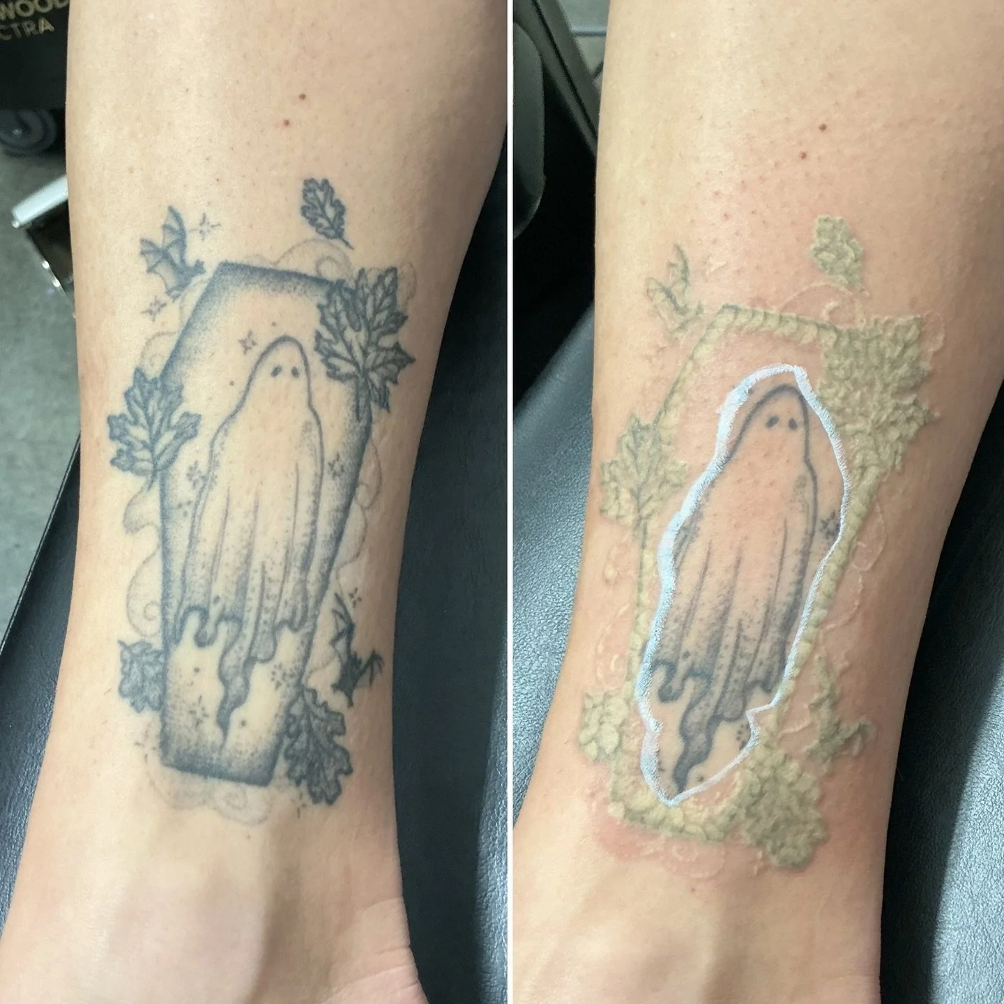 Did you know you can target certain areas of your tattoo for removal?👻 

#pittsburgh #tattoo #tattooremoval #412 #lasertattooremoval