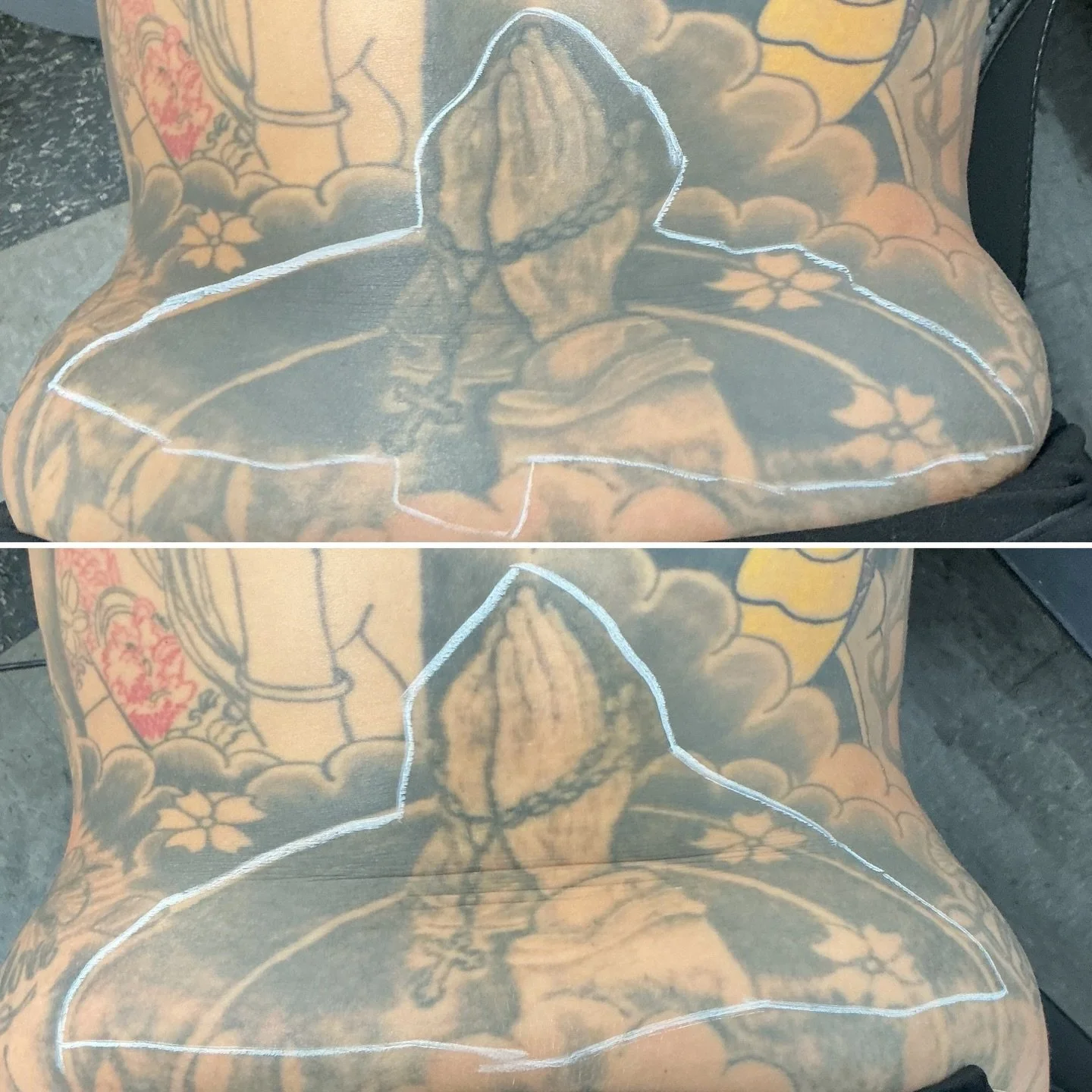 1st treatment results! We are fading for a cover-up with @donmcdonaldtattoo so she will only need a few more!
.
.
.
.
.
#lasertattooremoval #tattooremoval #tattoos #pittsburgh #laserremoval