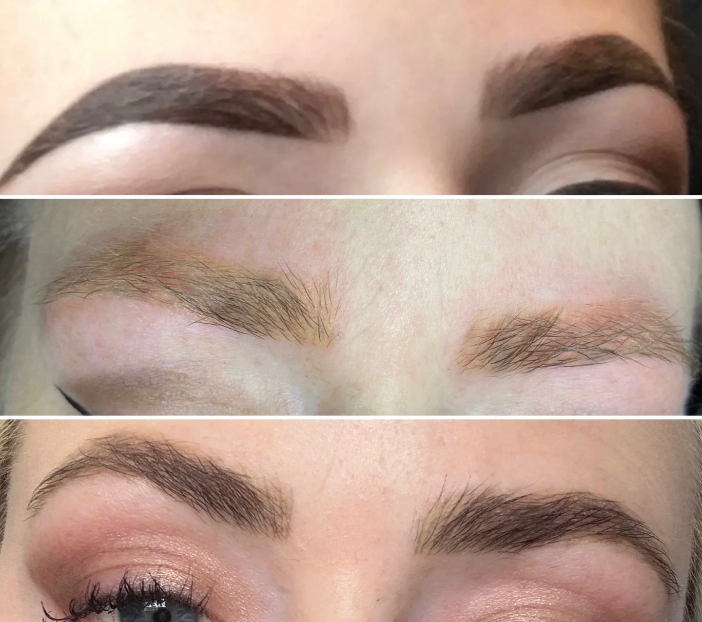 I loved my dark microbladed eyebrows when I was younger but as I got older, I wanted a softer and more natural look. After 2 laser removal treatments @domonique.izora was able to cover them with lovely little hair strokes. 

We offer free consultatio
